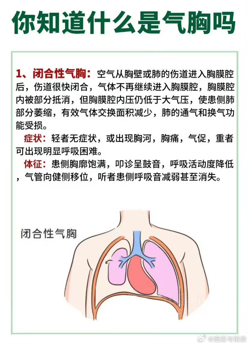 为什么高瘦男性容易得气胸